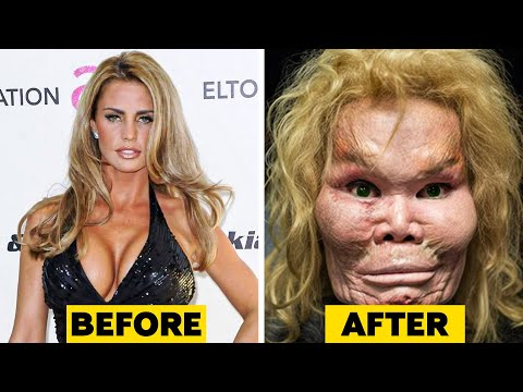 20 Celebrity Plastic Surgery Disasters