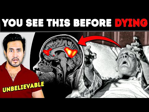 Scientists Finally Discovered What You SEE Before You DIE | Medical Science Case Studies